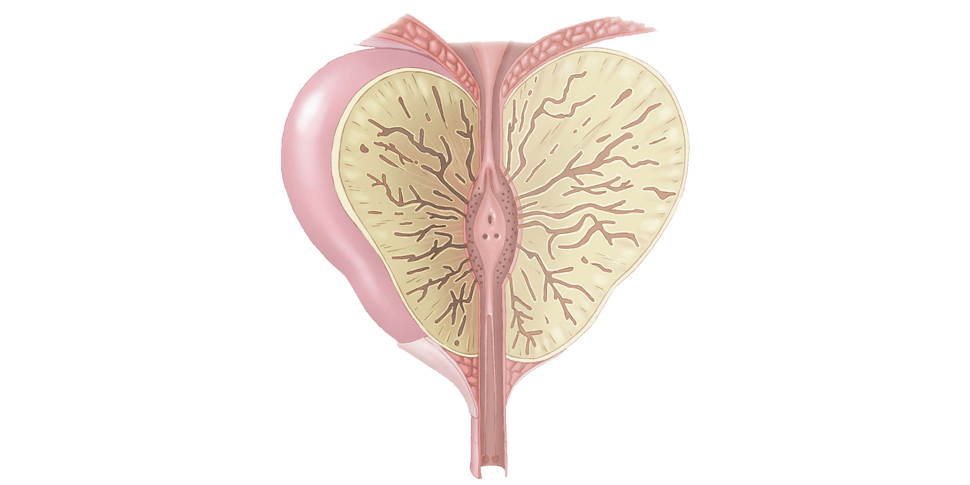 Problemas con la próstata - signos y síntomas de una enfermedad
